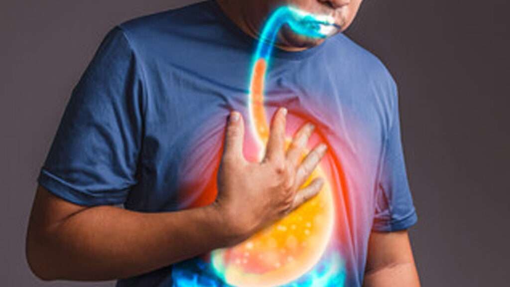 acidity 