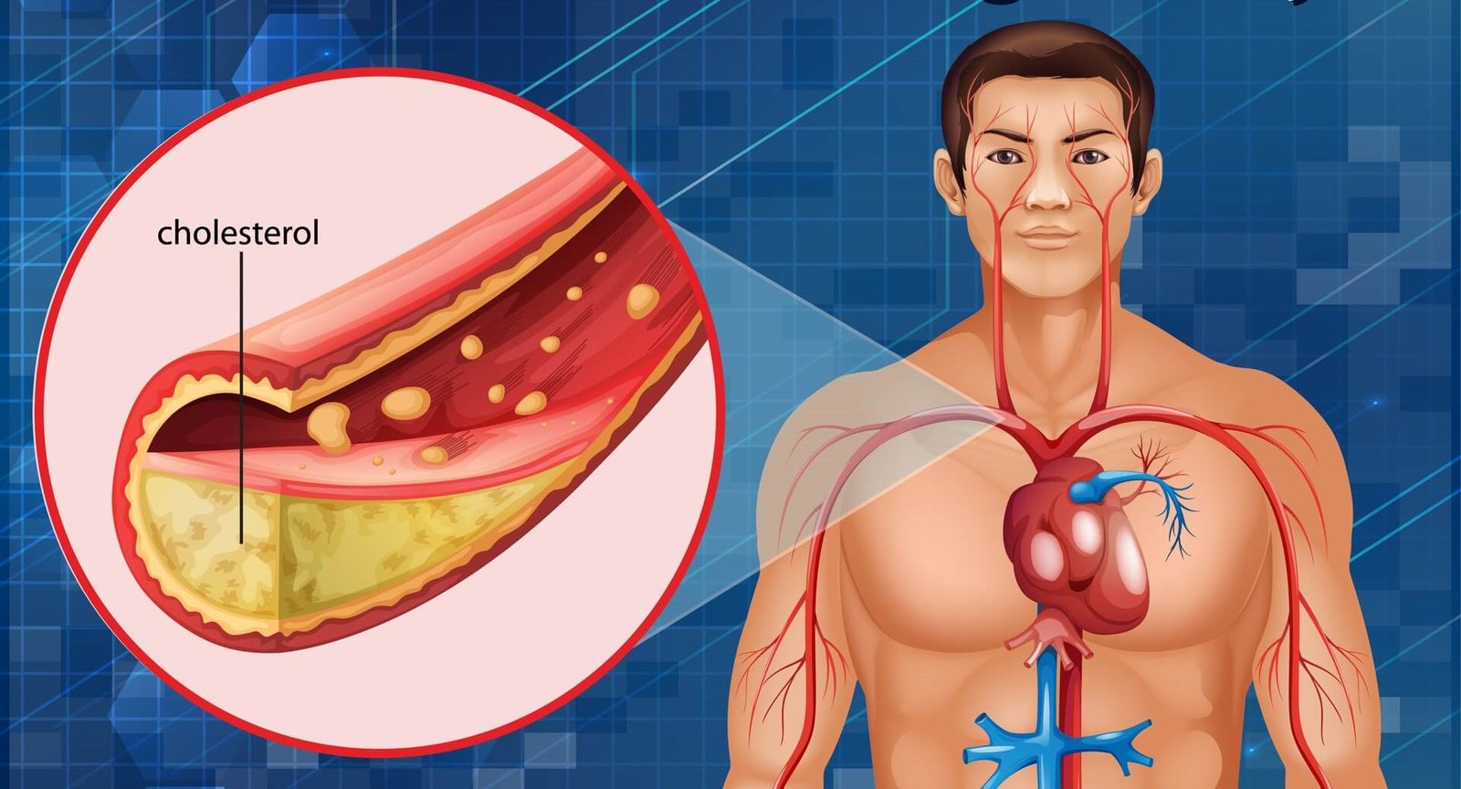 Best Ayurvedic Treatment for Cholesterol Problem