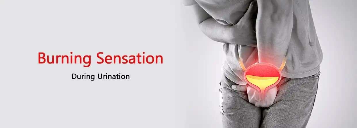 Best Ayurvedic Treatment for Burning Micturition (Burning Urination)