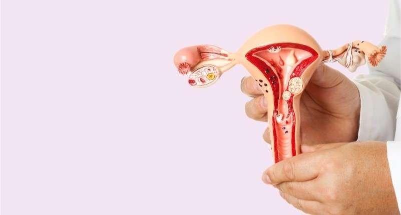 Best Ayurvedic Treatment for Uterine Fibroids (Rasauli): Causes, Symptoms, Remedies & Medicine