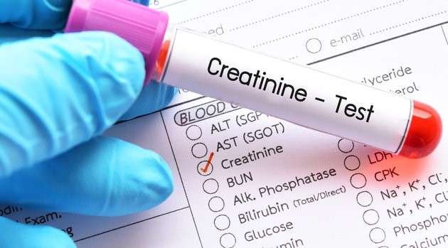 Best Ayurvedic Treatment to Control Creatinine Levels: Causes, Symptoms & Natural Remedies