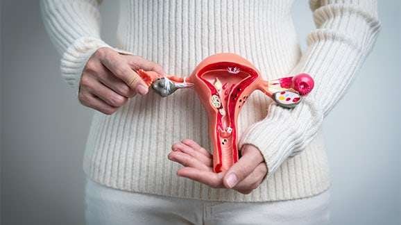 What is an Ovarian Cyst? Causes, Symptoms & Ayurvedic Perspective
