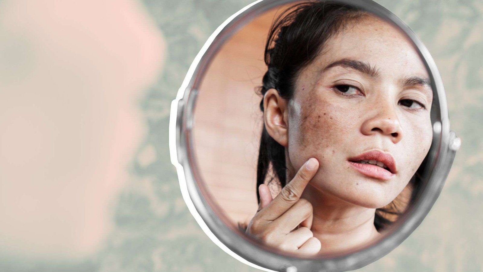 Dark Spots: Causes, Symptoms & Treatment
