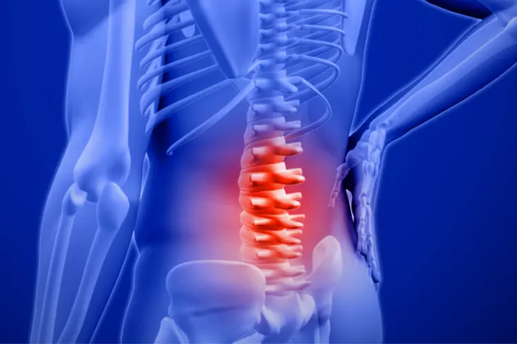 10 Signs of Ankylosing Spondylitis You Should Not Ignore
