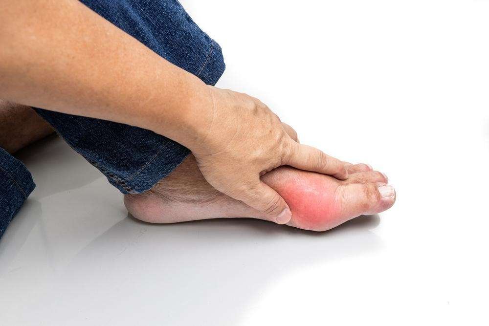 10 Signs of High Uric Acid You Should Not Ignore