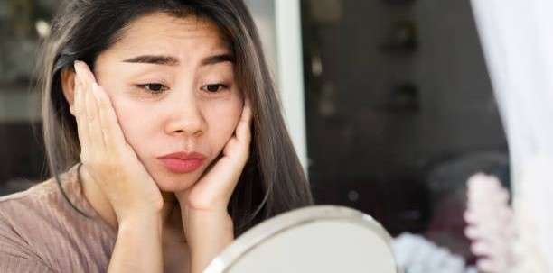 10 Best Remedies for Dark circles (Natural & Ayurvedic)