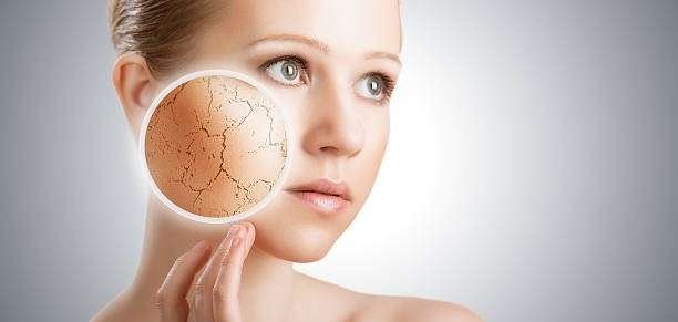 Dry Skin: Ayurvedic Guide to Causes, Care & When to Consult