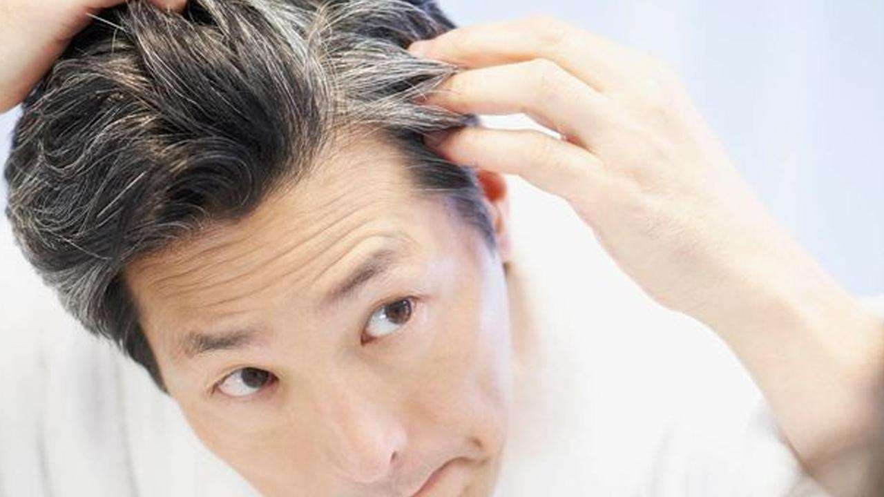 White Hair Problem: Ayurvedic Causes, Care & When to Consult