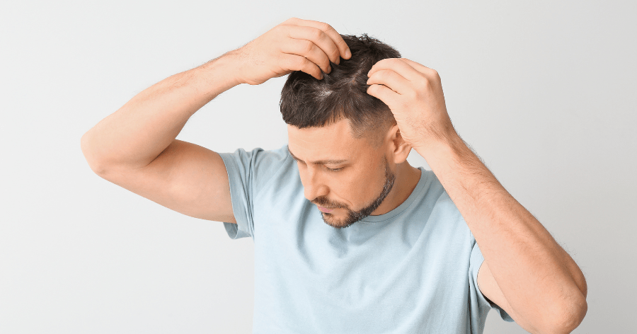 Remedies for Weak Hairs: 10 Best Ayurvedic Solutions