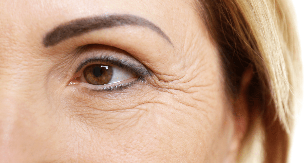 10 Remedies for Wrinkles (Ayurvedic & Natural)