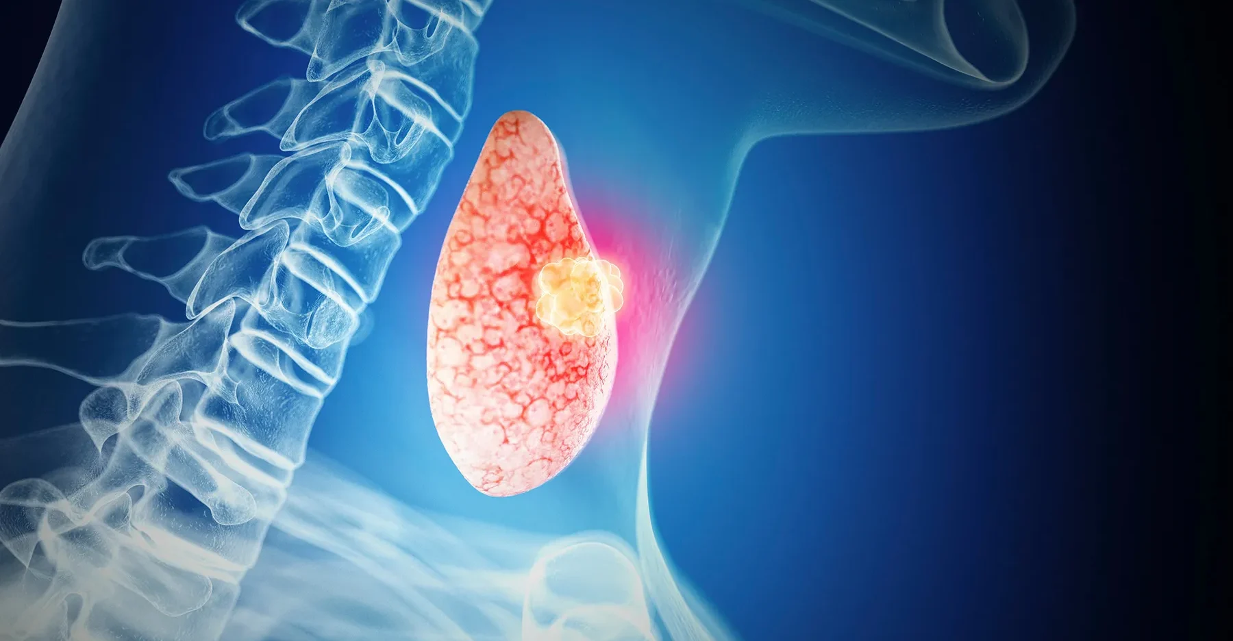 Signs your thyroid is getting worse